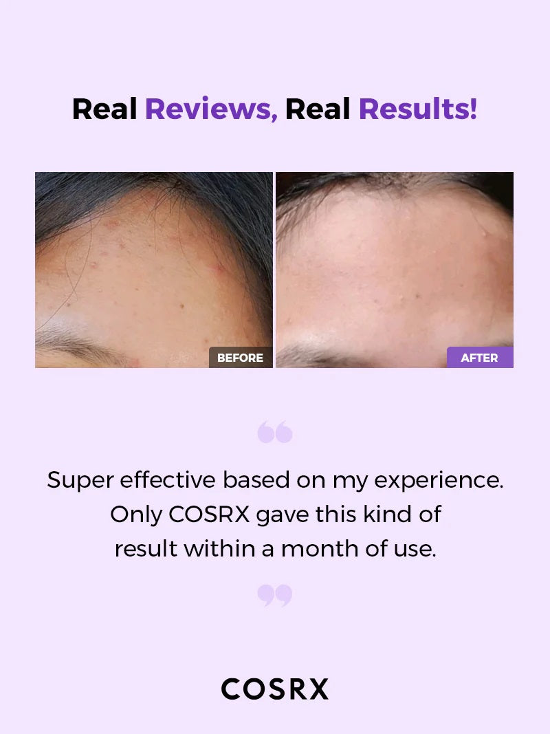 Cosrx AHA BHA Clarifying Treatment Toner Hookskorea Korean Skincare Korea cosmetics